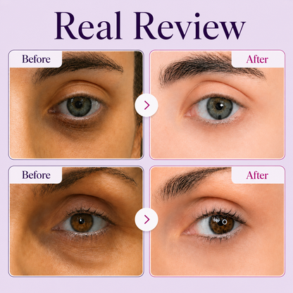 Rolimey® Calcium Dark Spot Eye Cream