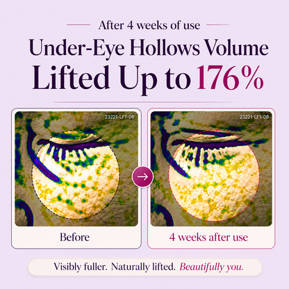 Rolimey® Calcium Dark Spot Eye Cream